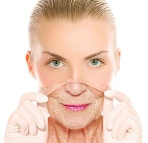 Rajeunissement au laser