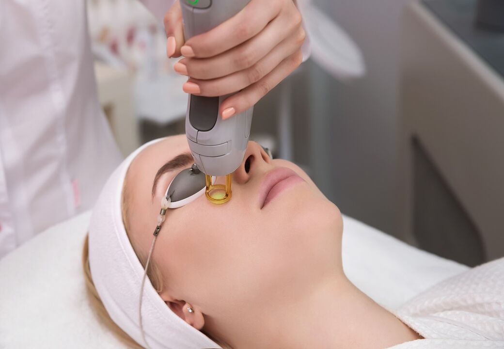Rajeunissement au laser
