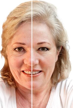 Face à rajeunissement