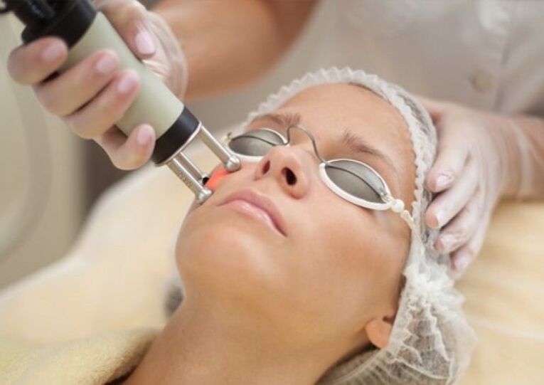 Procédure de rajeunissement au laser sur le terrain